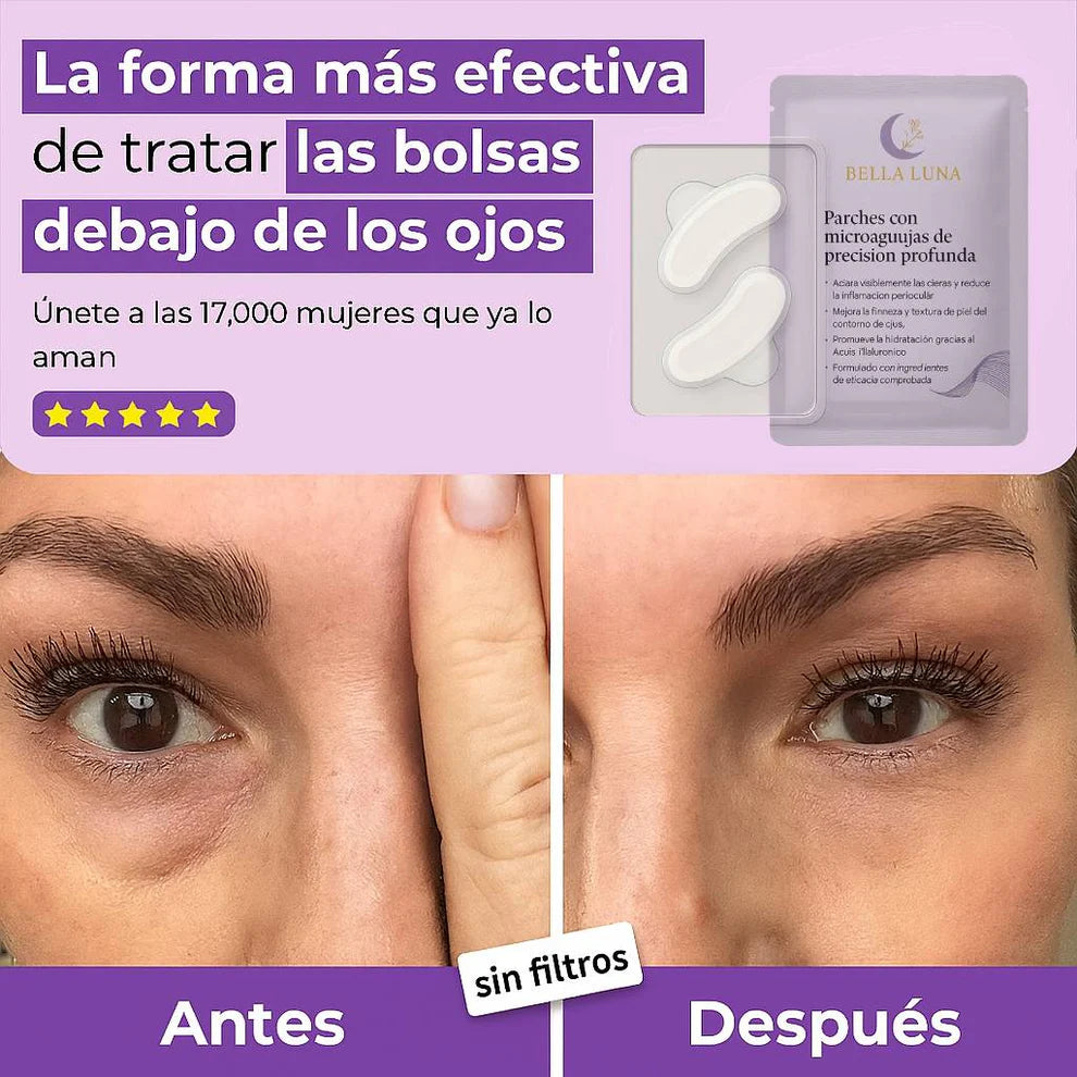 2X1/  Parches de Microagujas + Ácido hialurónico para ojeras, bolsas y arrugas