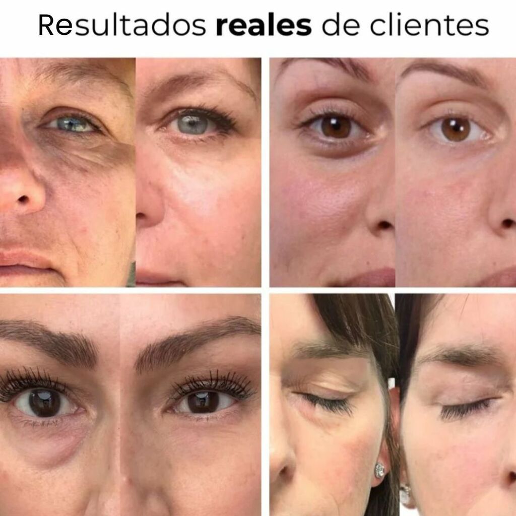 Parches PuraDerma™ Firmeza y Elevación